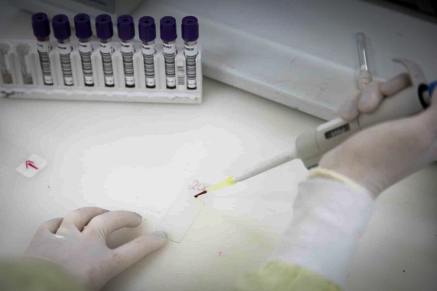 Negativo para ebola: resultado clínico afasta risco em paciente na capital paulista