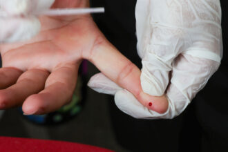 Brasil pleiteia certificado da Opas após derrubar transmissão vertical de hepatite B