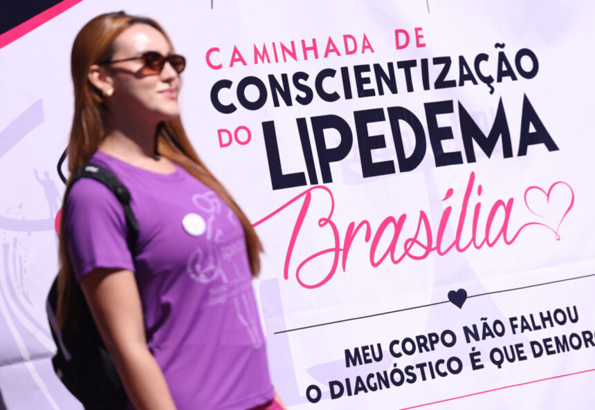 Lipedema afeta uma em cada dez brasileiras e mobiliza caminhadas em 26 cidades