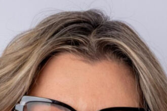 Menopausa e dor na relação íntima deixam de ser tabu com tratamentos focados no bem-estar