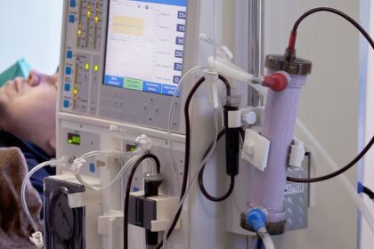 Subdiagnóstico da doença renal crônica atinge milhões de brasileiros por falha na triagem