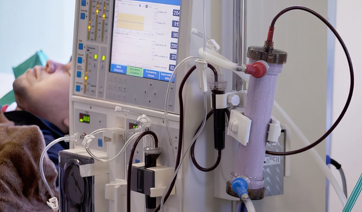 Subdiagnóstico da doença renal crônica atinge milhões de brasileiros por falha na triagem