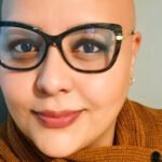 Alopecia areata desafia pacientes a redefinir a própria identidade além da aparência