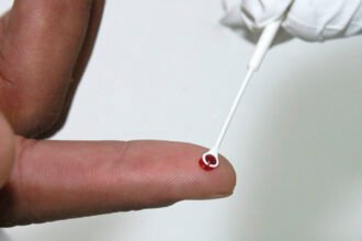 Fiji decreta estado de emergência sanitária diante da rápida disseminação do HIV