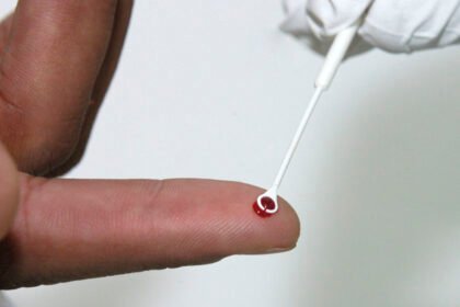 Fiji decreta estado de emergência sanitária diante da rápida disseminação do HIV