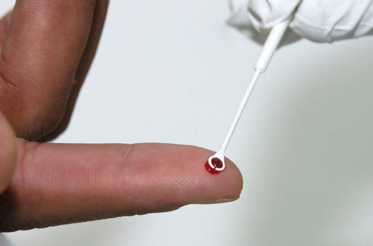Fiji decreta estado de emergência sanitária diante da rápida disseminação do HIV