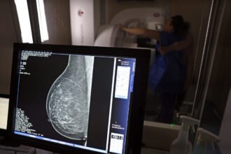 Planos de saúde passam a cobrir mamografia digital sem restrição de idade a partir de outubro